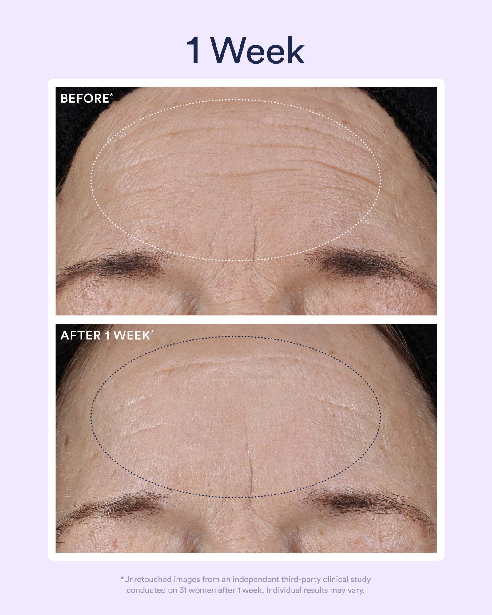 5-DNS_PDP_BEFORE_AFTER_1_1600x2000_ad5a106c-c626-4118-adcc-6aca21c5bef0.jpg