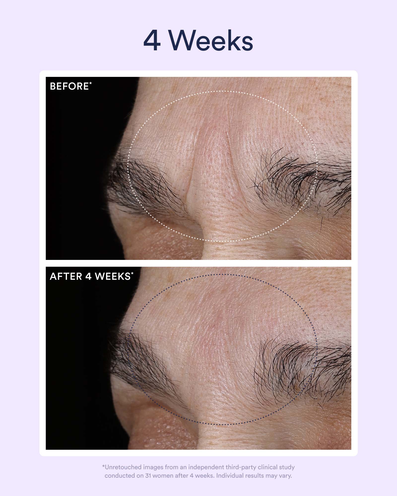 5-DNS_PDP_BEFORE_AFTER_2_1600x2000_b46d3ba5-e27a-4468-99dd-37d4c2e97fd6.jpg